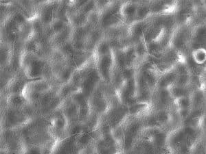 plating aluminum with alcoat at x500