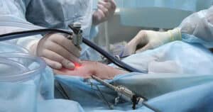 fluid mechanics playing a role in a veterinary operating team performing laparoscopic sterilization on a dog.