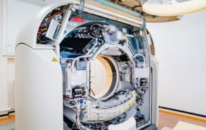 Closeup picture of a computed tomography (CT) scanner gantry with bearing friction.